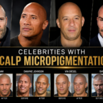 celebrities with scalp micropigmentation